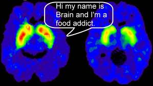 brainaddict